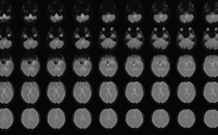 Unlocking Minds: Scientist Translates Thoughts into Text with ‘Mind-Captioning’ Technology | PRIMENEWSNOW