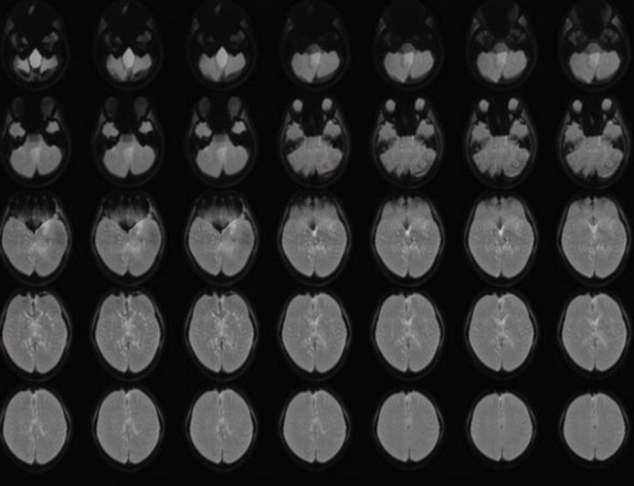 Unlocking Minds: Scientist Translates Thoughts into Text with ‘Mind-Captioning’ Technology | PRIMENEWSNOW