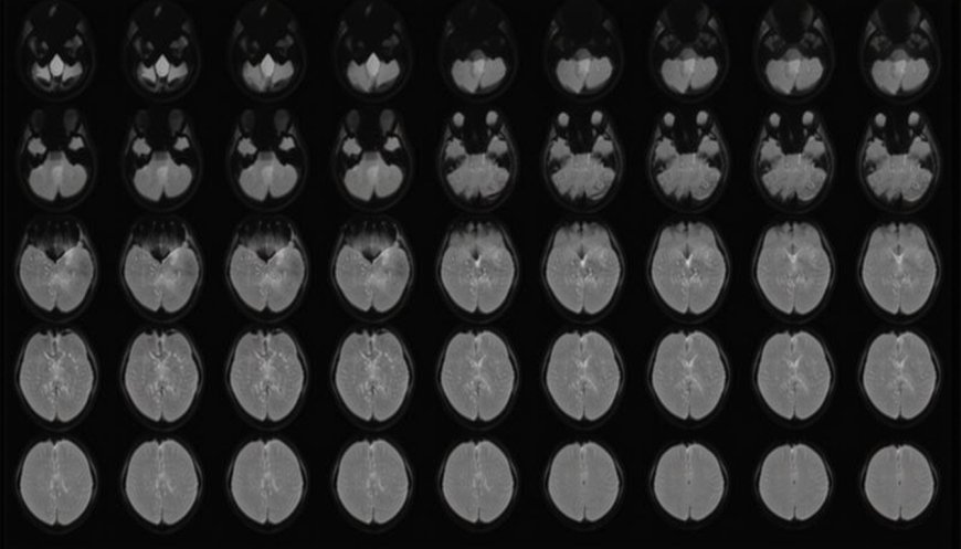 Unlocking Minds: Scientist Translates Thoughts into Text with ‘Mind-Captioning’ Technology | PRIMENEWSNOW